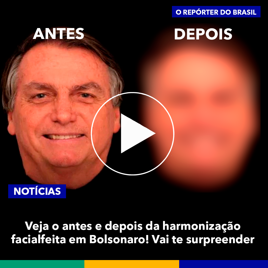 Bolsonaro faz harmonização e coloca dentes de R 88 mil Dicas do Dia